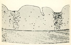 x section tanning dev two spots.jpg