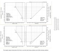 Zone Placement and Flare.jpg