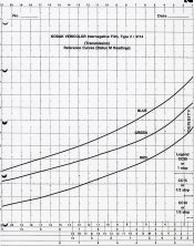 Internegative film curve.jpg