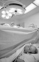 Cesarean Section Operation