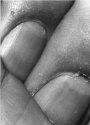 Finger Study