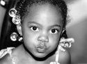 Kisses