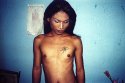 Nui Ladyboy Sex Worker, Thailand 2003