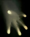 Man Burned To A Crisp