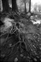 Exposed roots