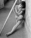 MSA - Skin: Under Glass