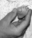 Tiny Big Toe