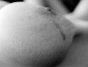 reconstructed