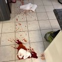 Had an accident