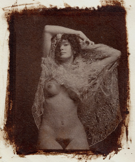 Albumen #3