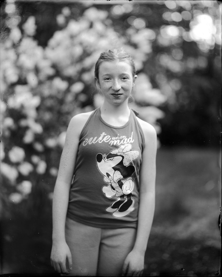 ASA 25 Ortho Dry Plate