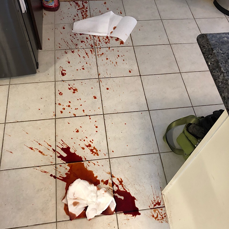 Had an accident