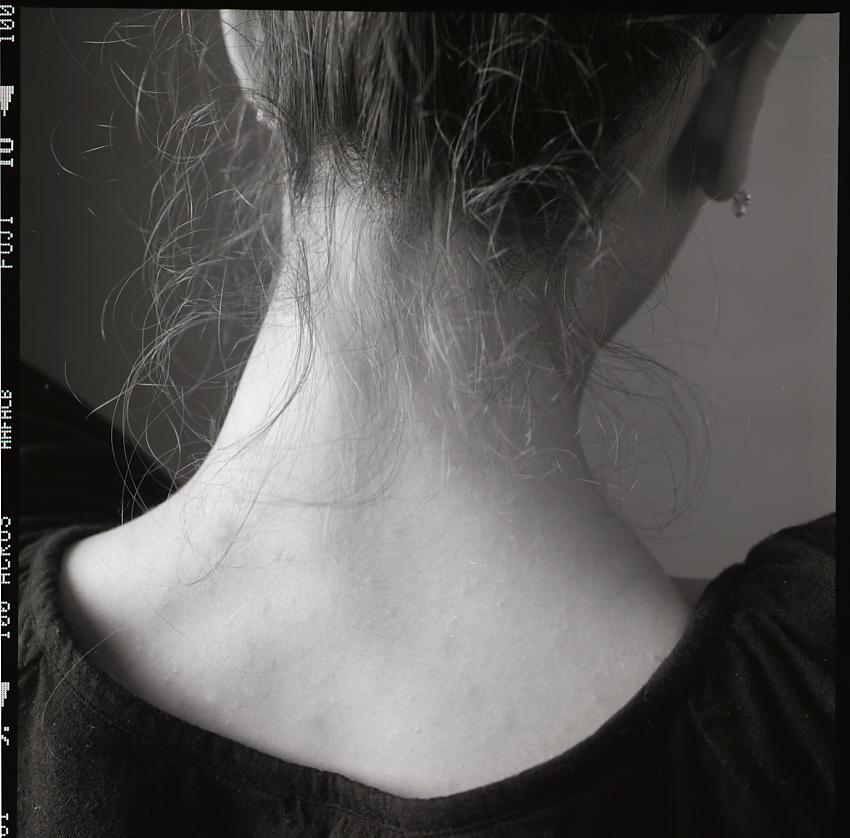 Nape