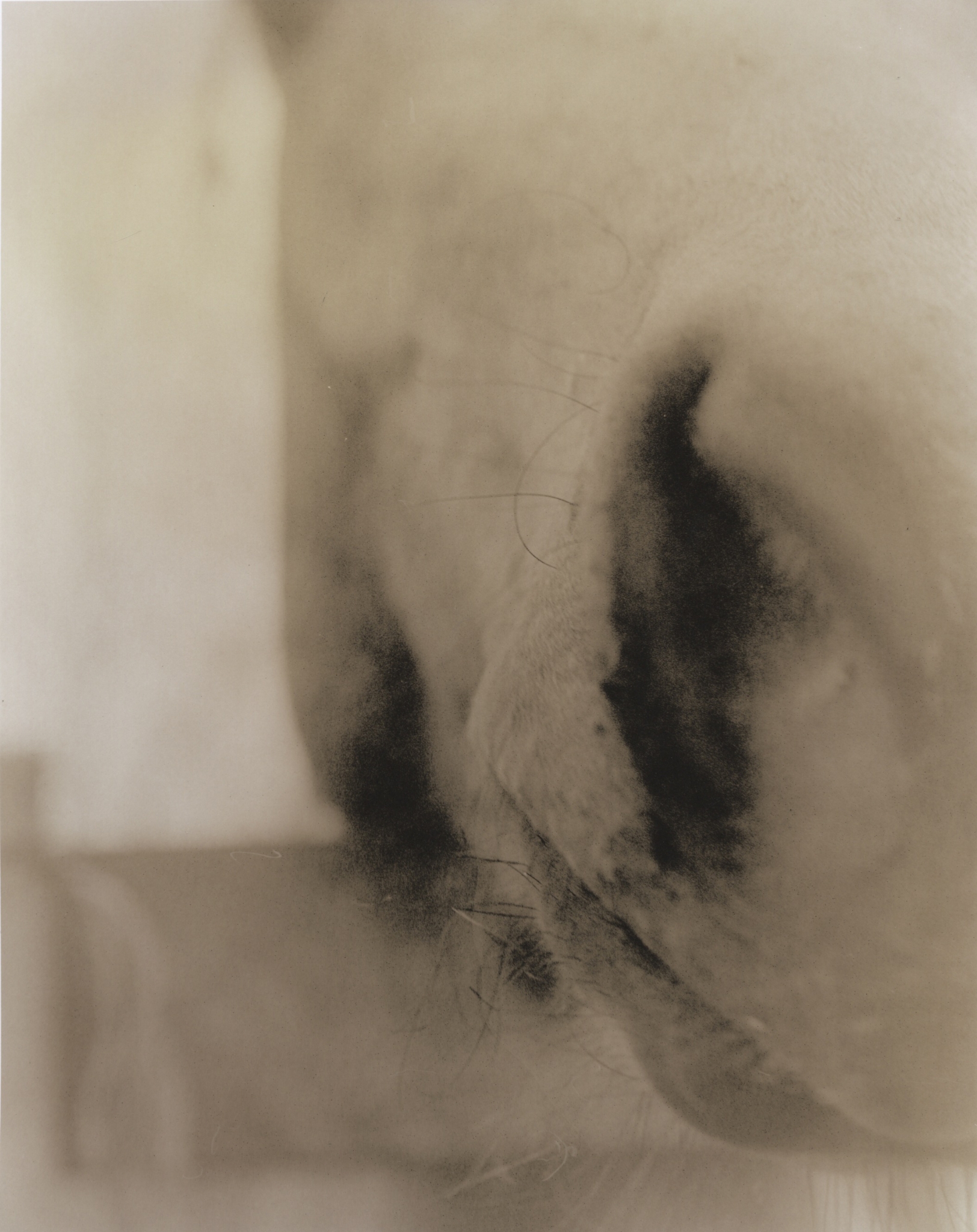 Nose 1