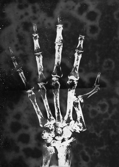 Radiography Experiment