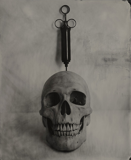 This Won't Hurt a Bit