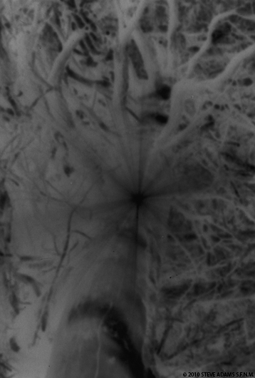 Tree Flare Negative