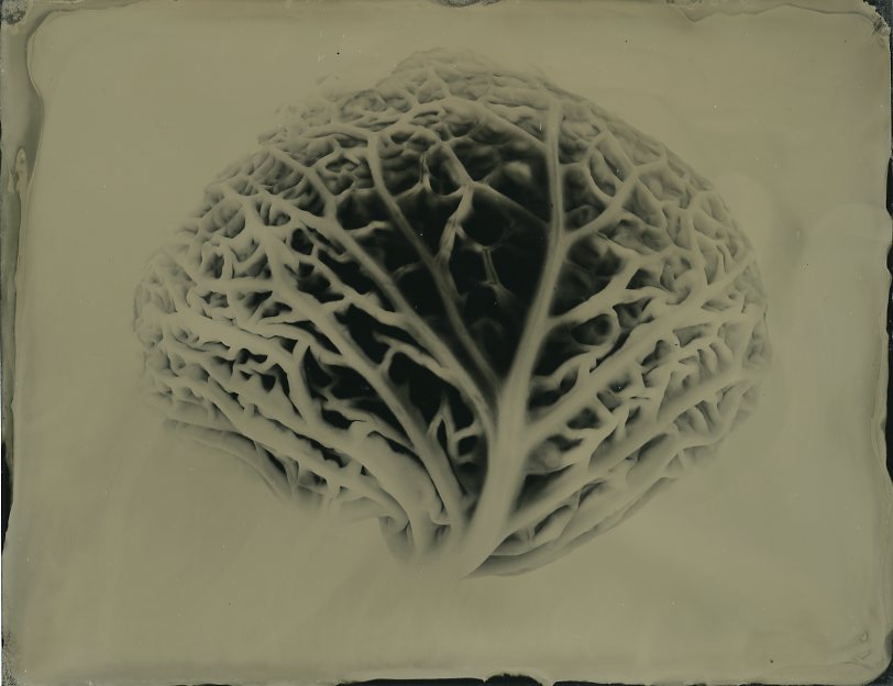 Vascular